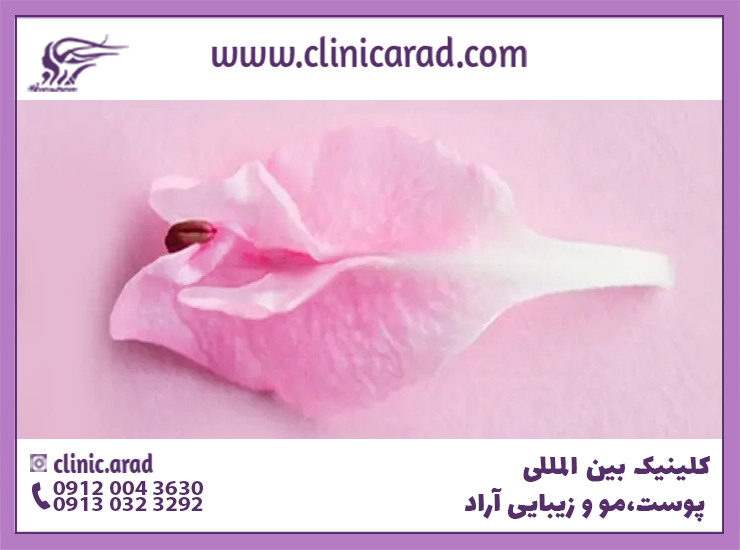 عکس نمادین گل یزای جراحی زیبایی لابیاپلاستی