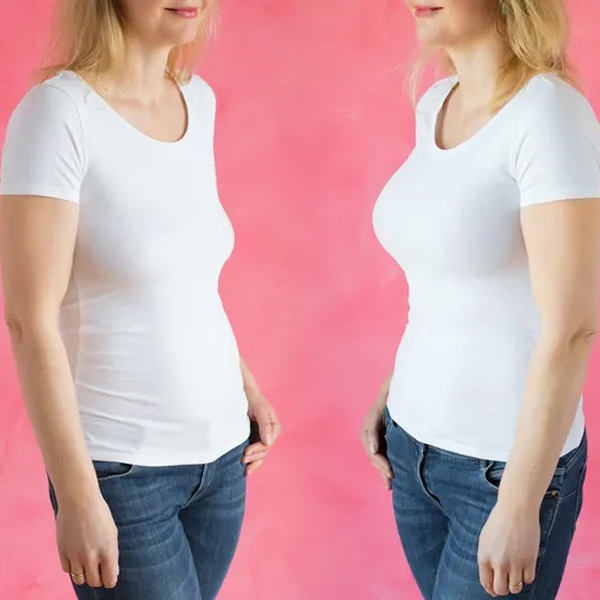 عکس قبل و بعد زنی که لیفت سینه انجام داده است